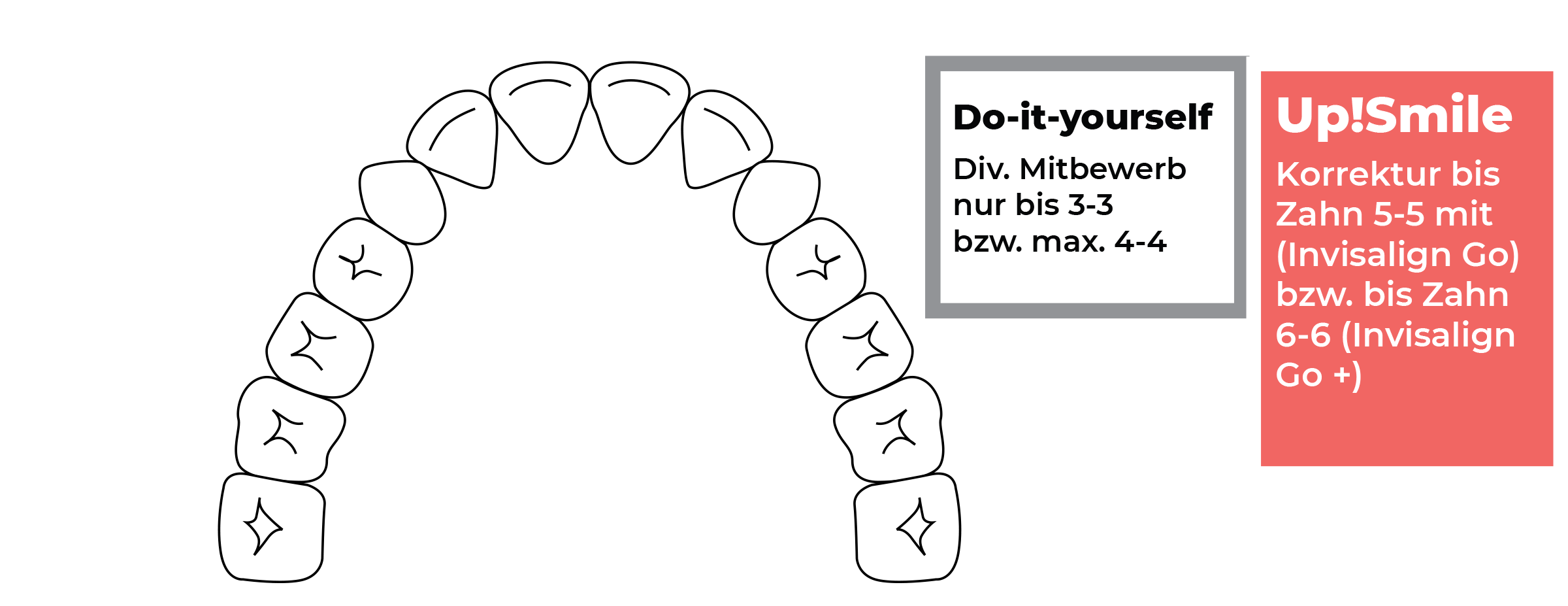 zahnbewegung-MB