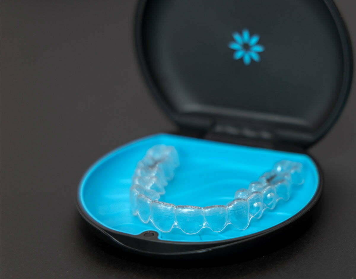 invisalign-dr-koettgen-upsmile-a-01