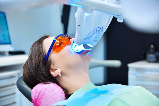 Teeth whitening for patient in protective glasses. Home Bleachng, In-Office Bleaching, Power Bleaching in Mainz