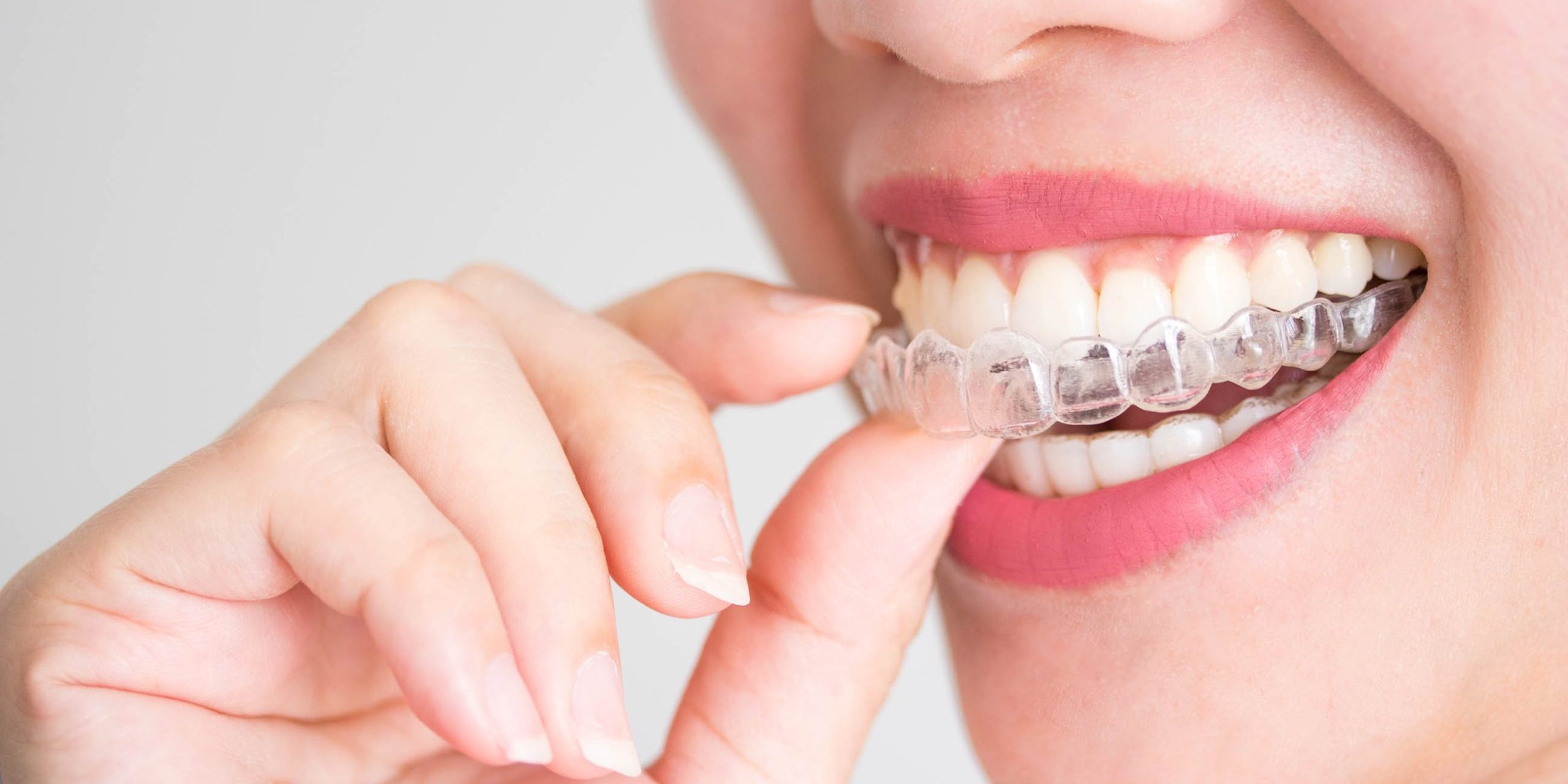 A smiling woman holding invisalign or invisible braces, orthodon
